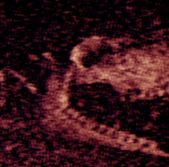 ���Σ�Iron Lung����Ϸ����v1.10 ��׿��