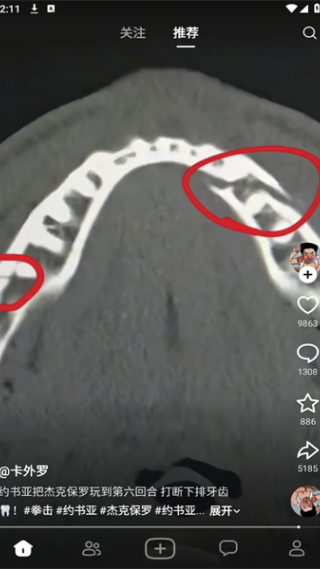 随变社区app下载 随变社区app下载