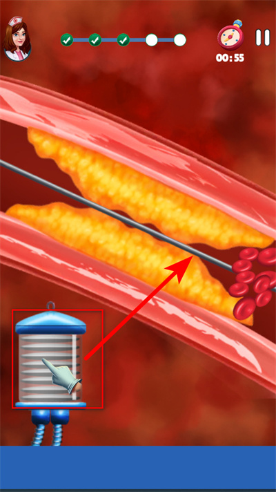 ���ҽ��ģ��������Ѫ����